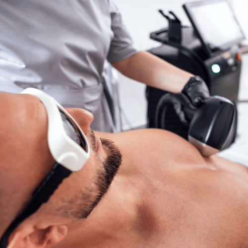 Épilation laser : pourquoi les résultats varient selon les personnes ?